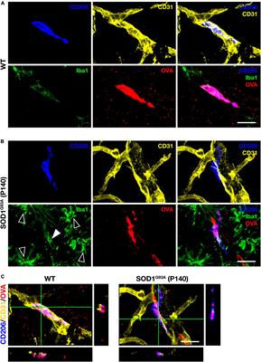 Depletion of perivascular macrophages delays ALS disease progression by ameliorating blood-spinal cord barrier impairment in SOD1G93A mice